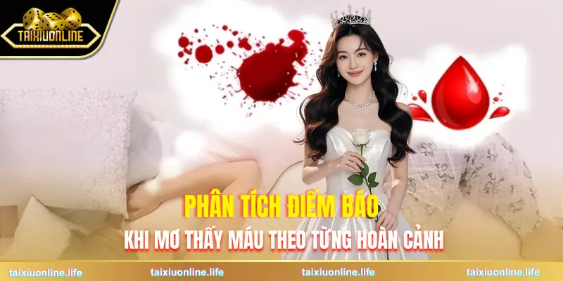 mo-thay-mau-diem-bao